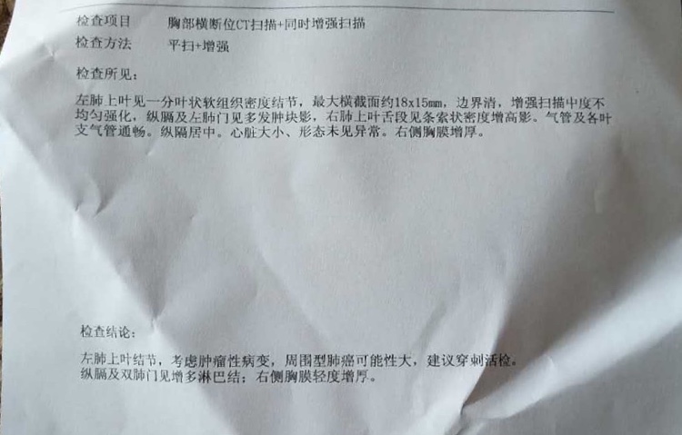 想咨询下手术是不是容易引起扩散,还有去重庆新桥医院看可以吗?