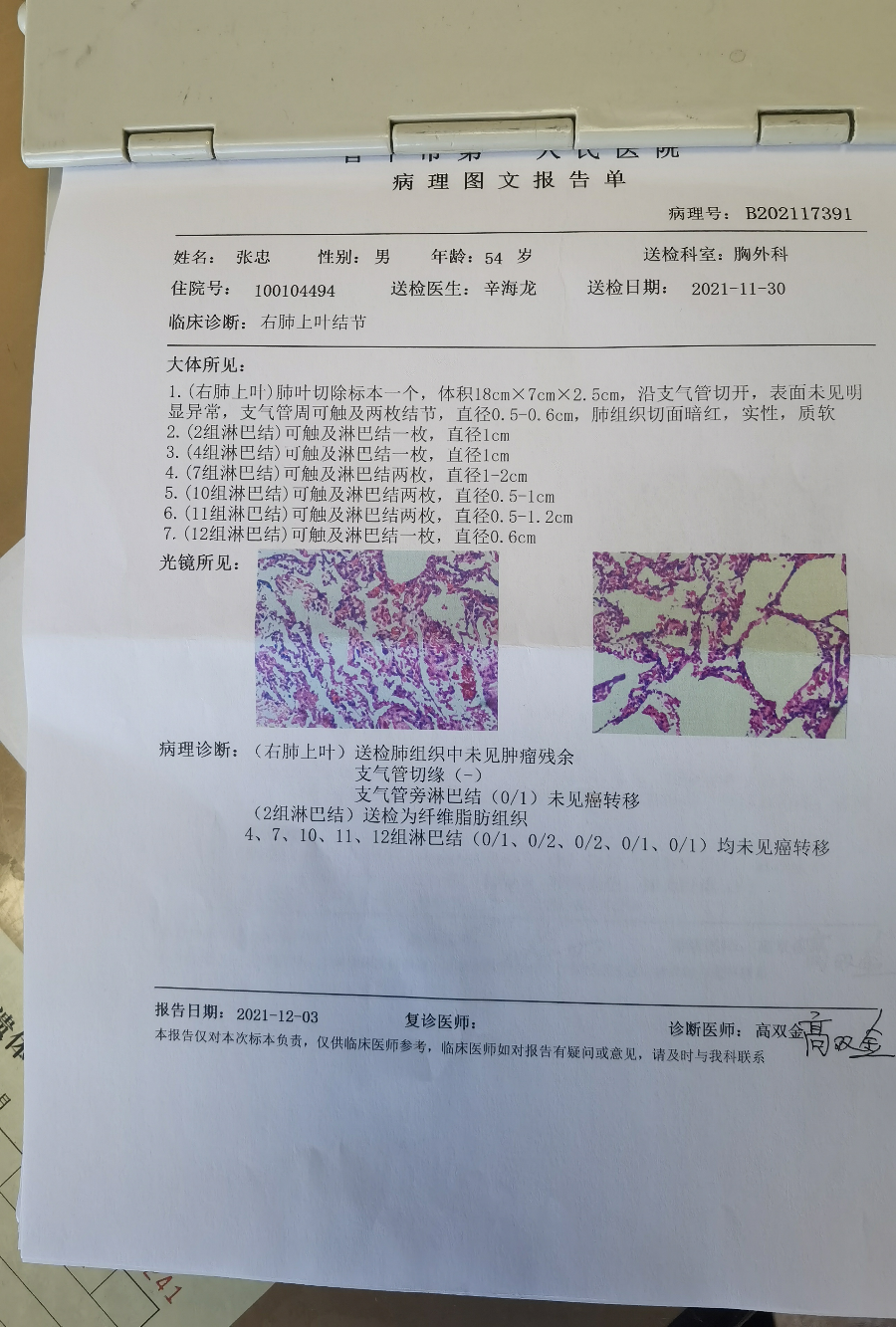 病理结果出来了,麻烦大家给看看_圈子 - 肺癌帮