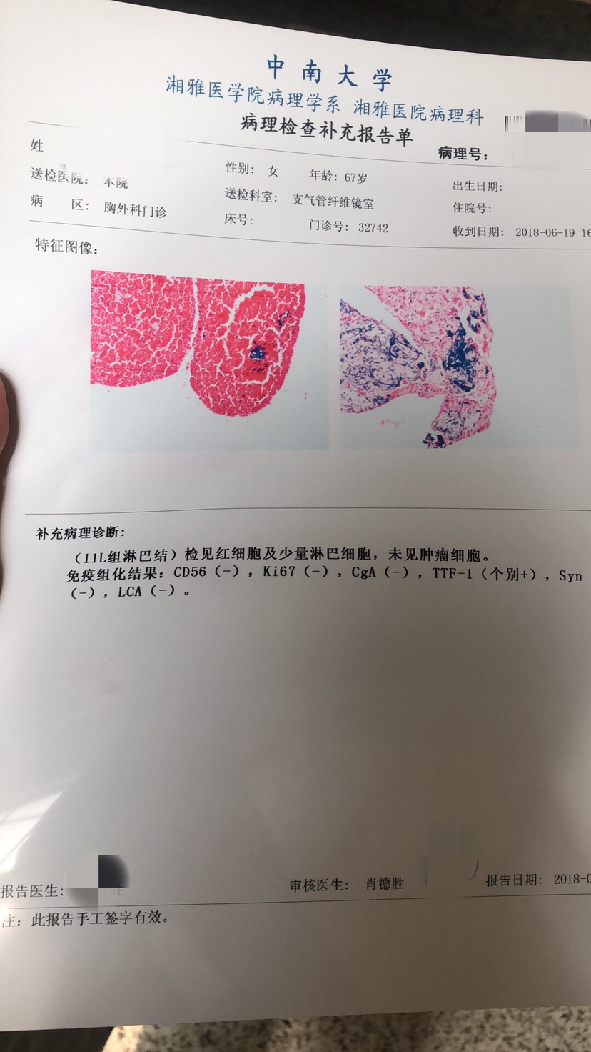 谁会看免疫组化结果急急急