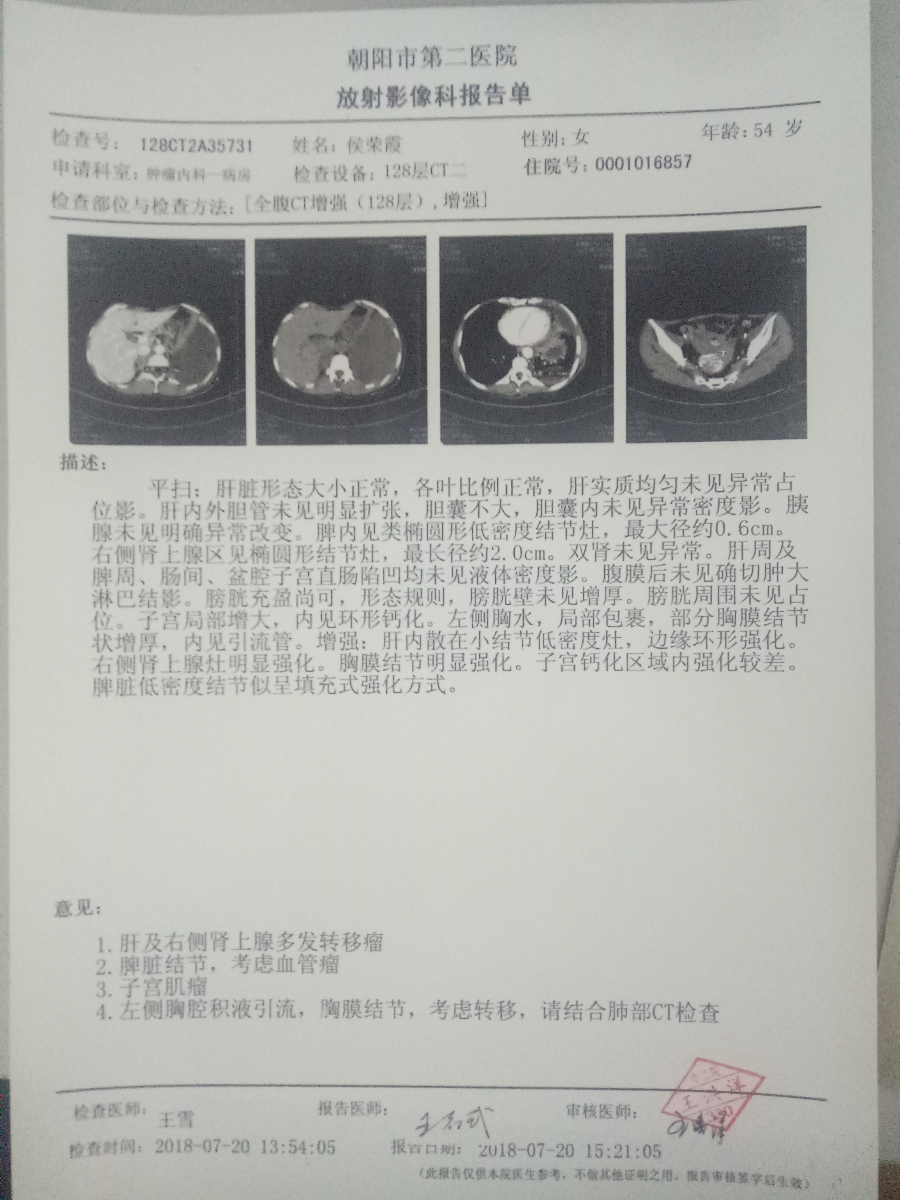 肺癌CT报告图片