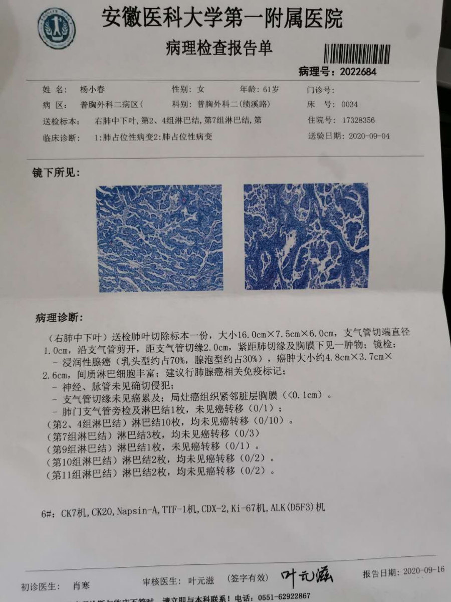 求助分析病理圈子 肺癌帮 9141