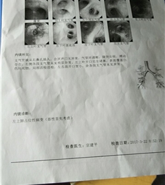 母亲肺腺癌